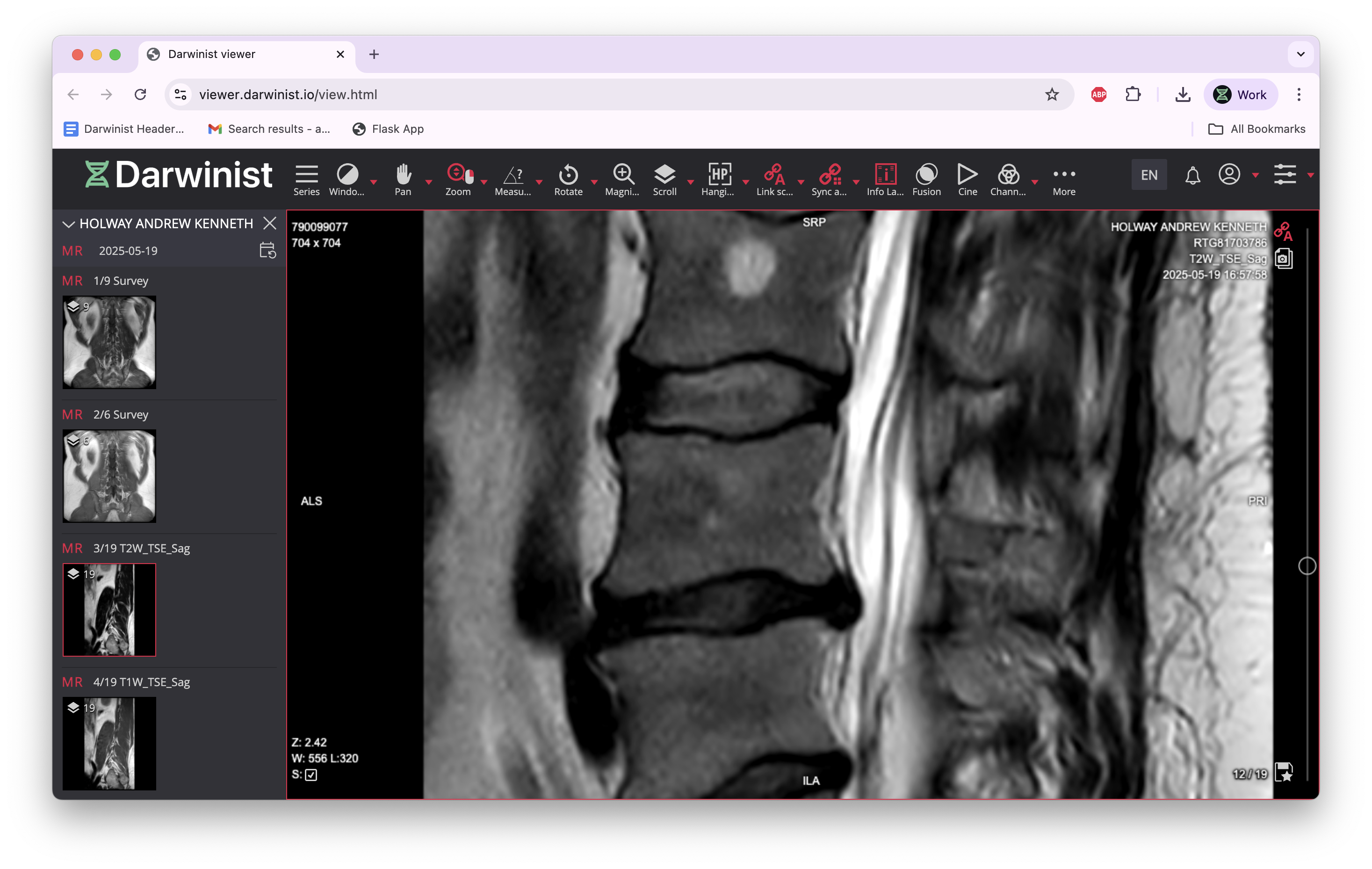 Radiology Viewer Screenshot